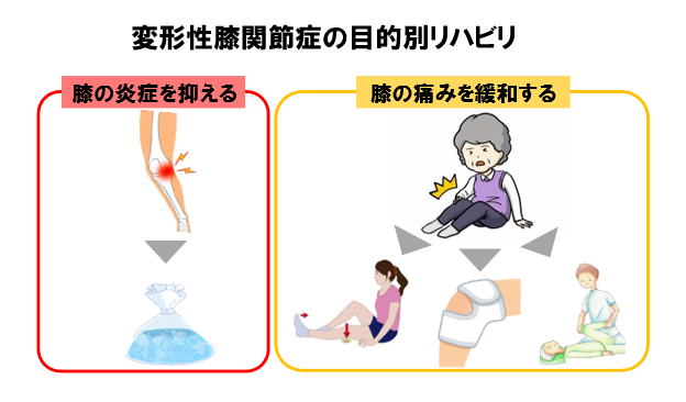 変形性膝関節症のリハビリを理学療法士が解説｜＜公式＞脳梗塞リハビリ