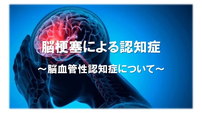 脳梗塞による認知症～脳血管性認知症について～